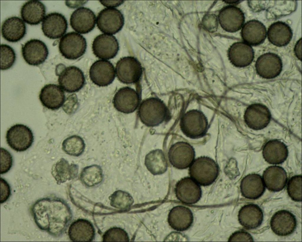Lepidoderma chailletii from zero altitude??